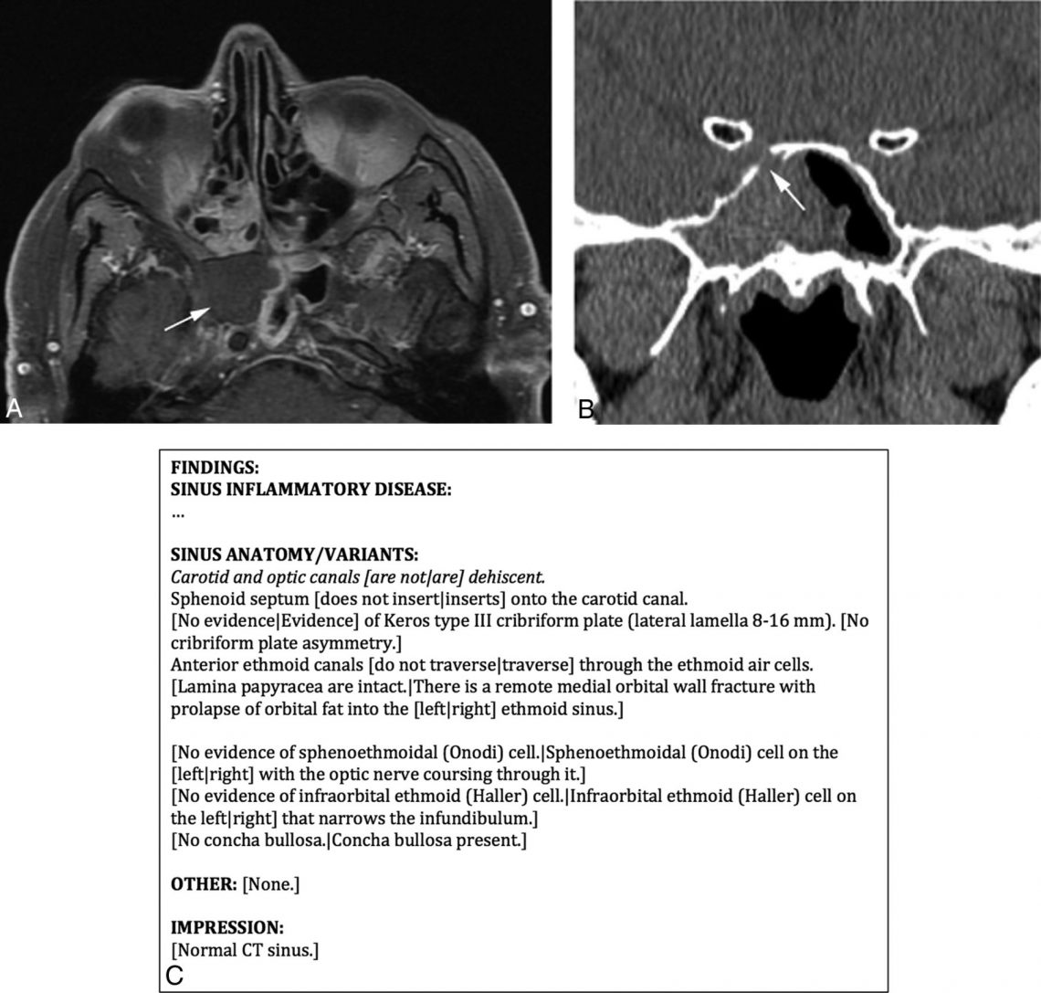 CT radiology report