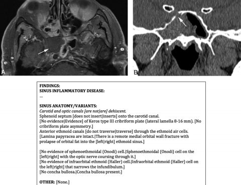 CT radiology report