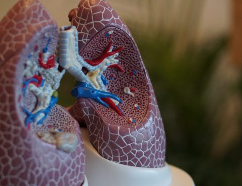 Radiation Doses for Lung Cancer Screenings Vary