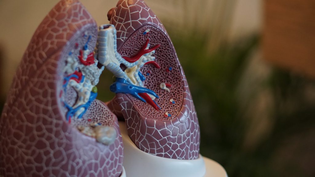 Radiation Doses for Lung Cancer Screenings Vary
