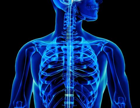 X-Ray, MRI, or CT Scan?