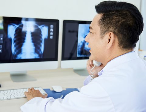 Kentucky sees increasse in lung cancer cases