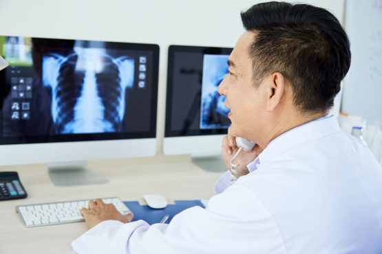 Kentucky sees increasse in lung cancer cases