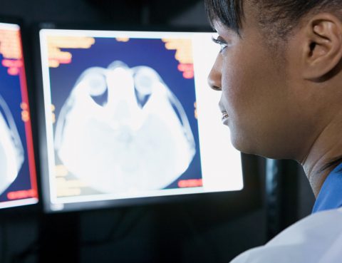 FDA Approves PET Imaging Compound to Aid Early Diagnosis and Disease Monitoring