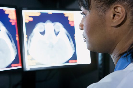 FDA Approves PET Imaging Compound to Aid Early Diagnosis and Disease Monitoring