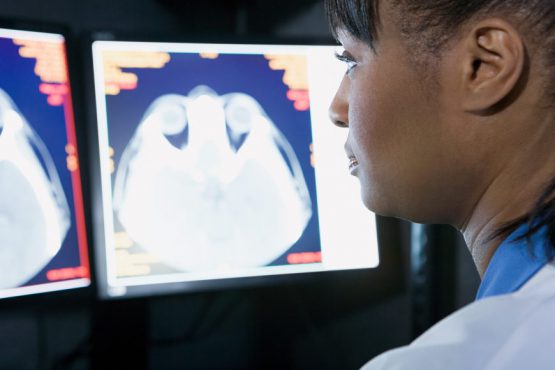 What is a PET scan?
